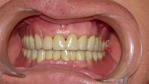 epanorthotiki odontiatriki