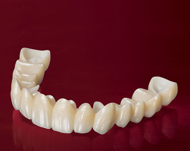 services-ic-bruxzir-original